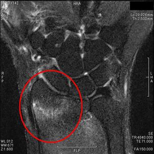 関節のMRI 職能別研修（放射線技師能力育成） | AR-Ex Medical Group